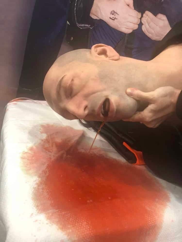 Mannequin with head injury and fake blood demonstration.