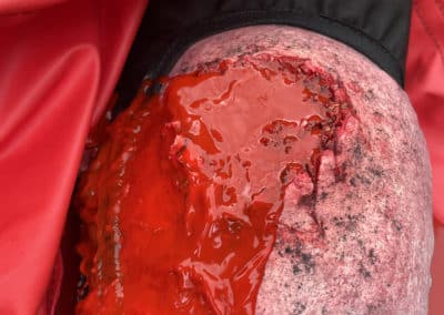 trauma bleed - Trauma Rescue Manikin
